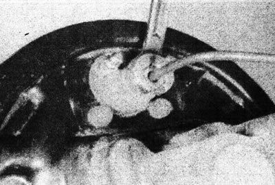 15.4. Адкруціце злучальную гайку.